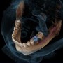 GALILEOS COMFORT PLUS - цифровое рентген устройство для получения высококачественных 3D-изображений всей зоны зубов
